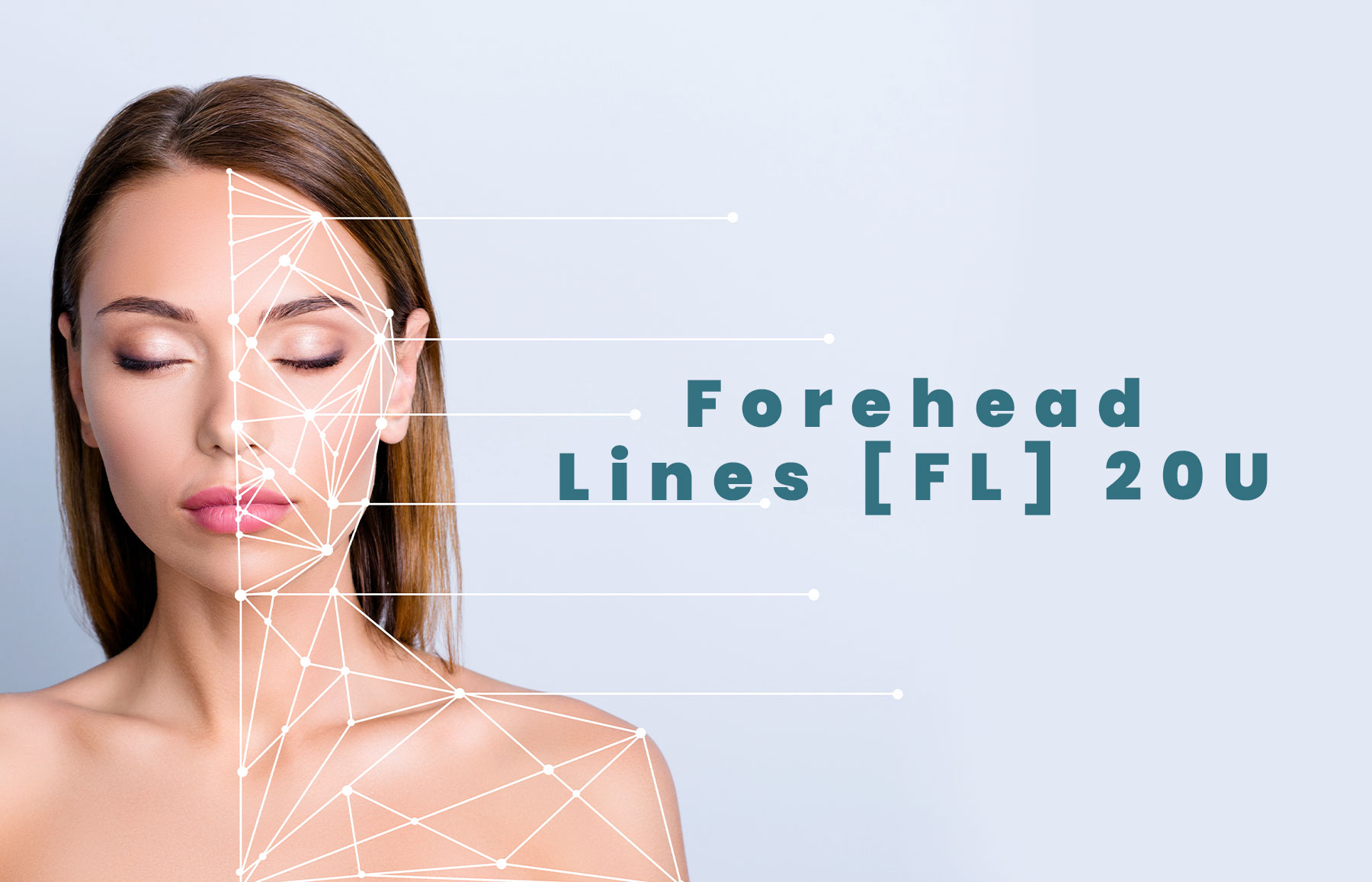 Forehead Lines [FL] 20U